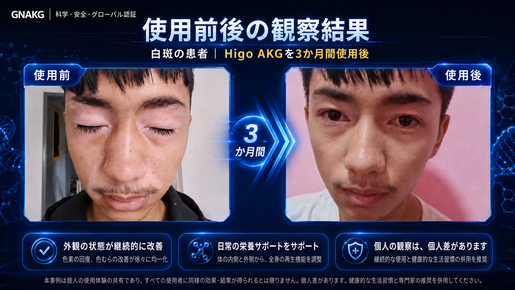 越境ECと報酬プラン