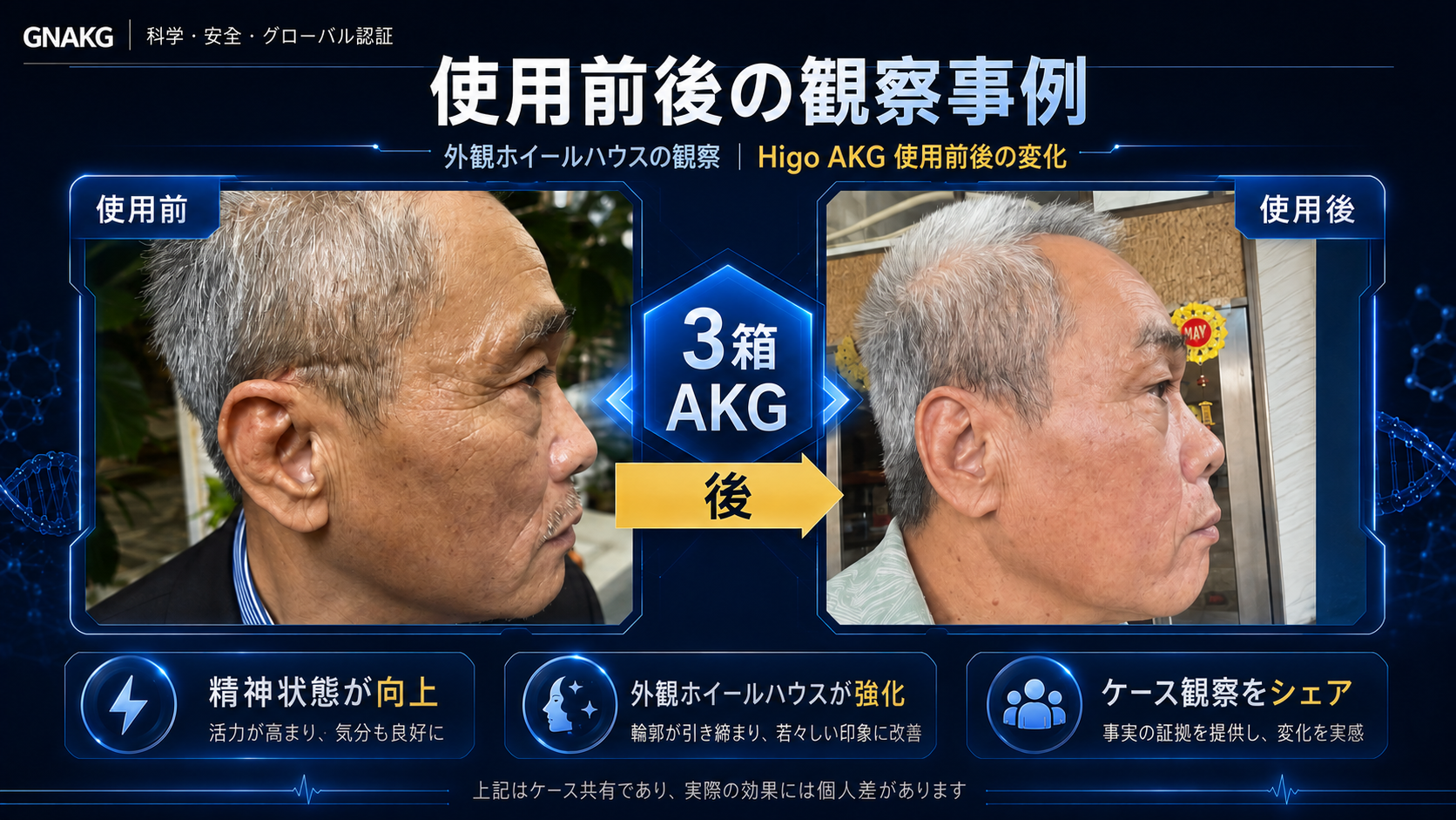 継続収入とグローバル事業