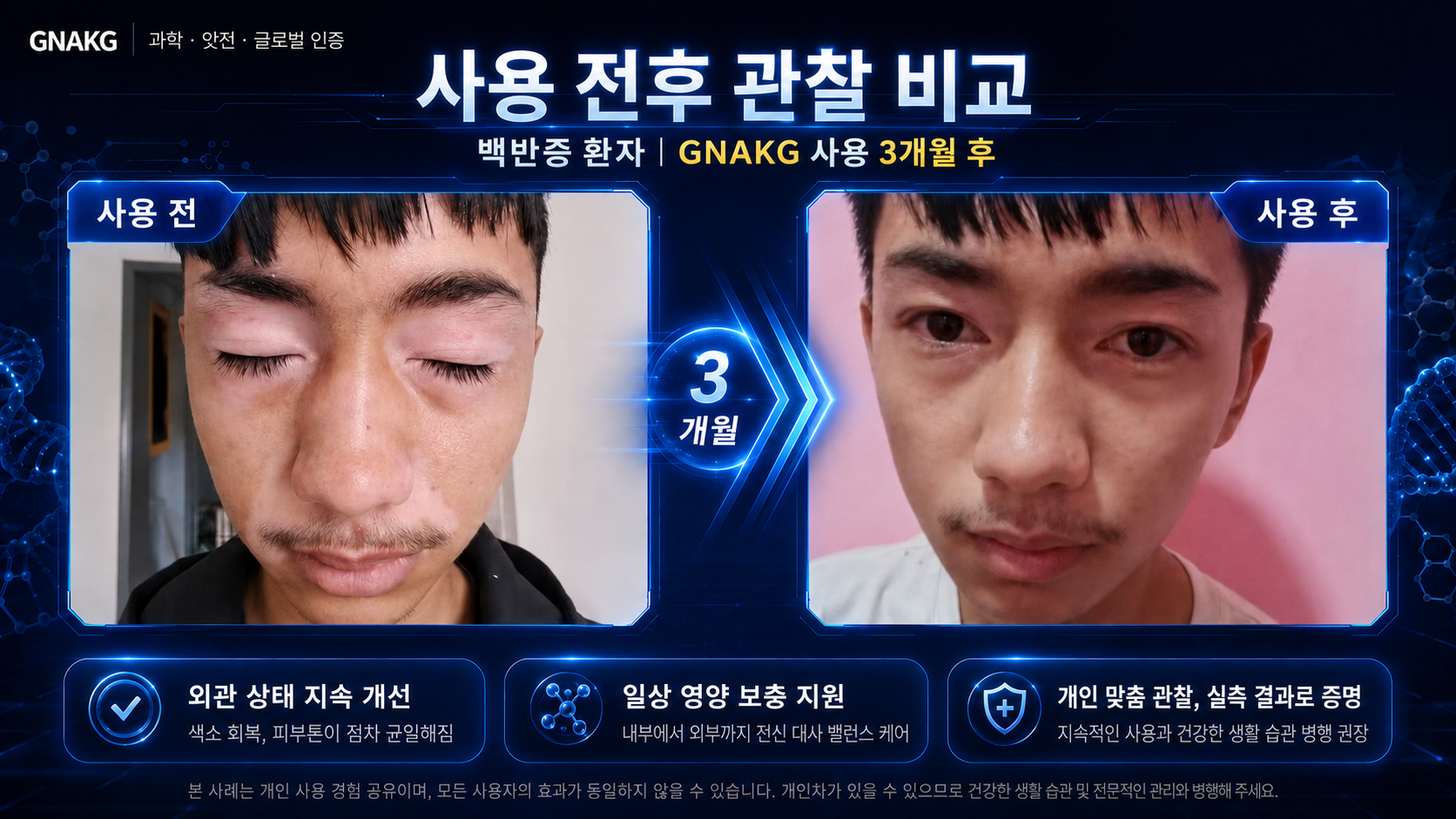 전자상거래와 보상플랜